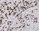 Human TMPRSS9 MAb (Clone 1042528) MAB5688