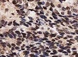 Human ER alpha /NR3A1 Antibody MAB57153