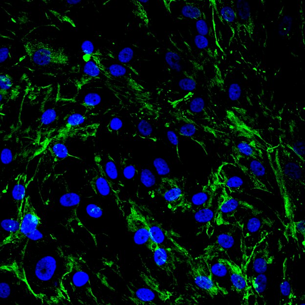 Human/Mouse/Rat Caveolin‑1 Antibody MAB5736