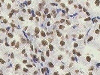 Human Brg1 Antibody MAB5738