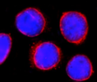 Human BTK Antibody MAB5807