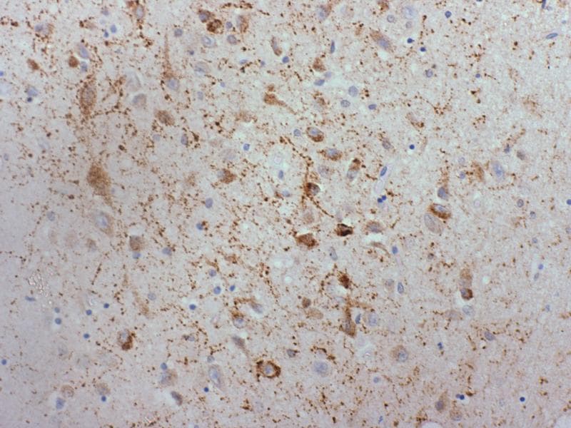 Human Galanin Antibody MAB5854