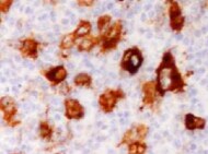 Human VAP‑B Antibody MAB58551