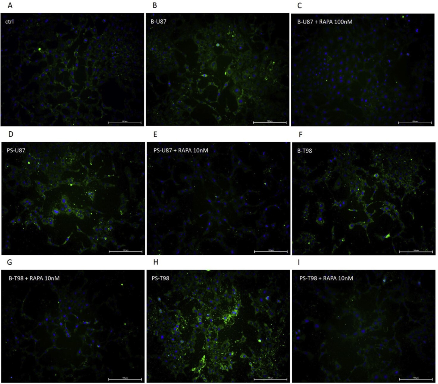 Human Arginase 1/ARG1 Antibody MAB5868