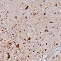 Human Aldehyde Dehydrogenase 1‑A1/ALDH1A1 Antibody MAB5869