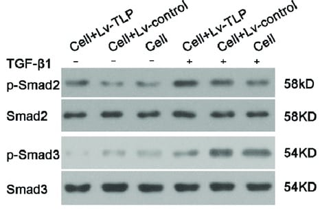 Human/Mouse TGF‑ beta  RI/ALK‑5 Antibody MAB5871