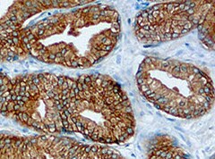 Human/Mouse/Rat Androgen R/NR3C4 Antibody MAB58761