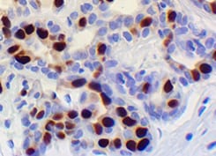 Human Androgen R/NR3C4 Antibody MAB58762