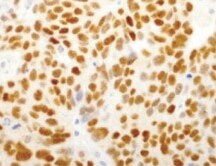 Human Progesterone R B/NR3C3 Antibody MAB5886