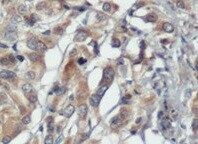 Human Nesfatin‑1/Nucleobindin‑2 Antibody MAB5949