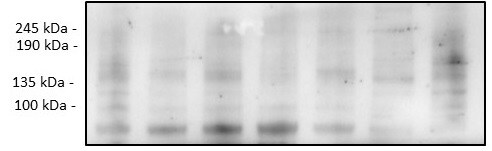 Human/Mouse RPTOR Antibody MAB5957