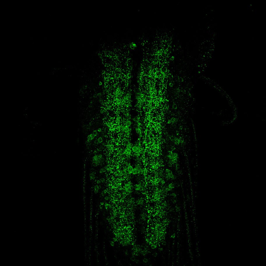 Human/Mouse VAMP‑1/VAMP‑2 Antibody MAB5958