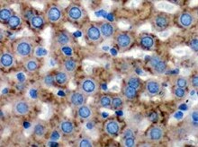 Human Cytosolic Sulfotransferase 1B1/SULT1B1 Antibody MAB5959