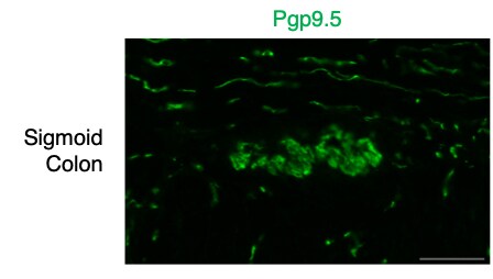 Human/Mouse/Rat UCH-L1/PGP9.5 Antibody MAB60072