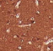 Human UCH-L1/PGP9.5 Antibody MAB6007