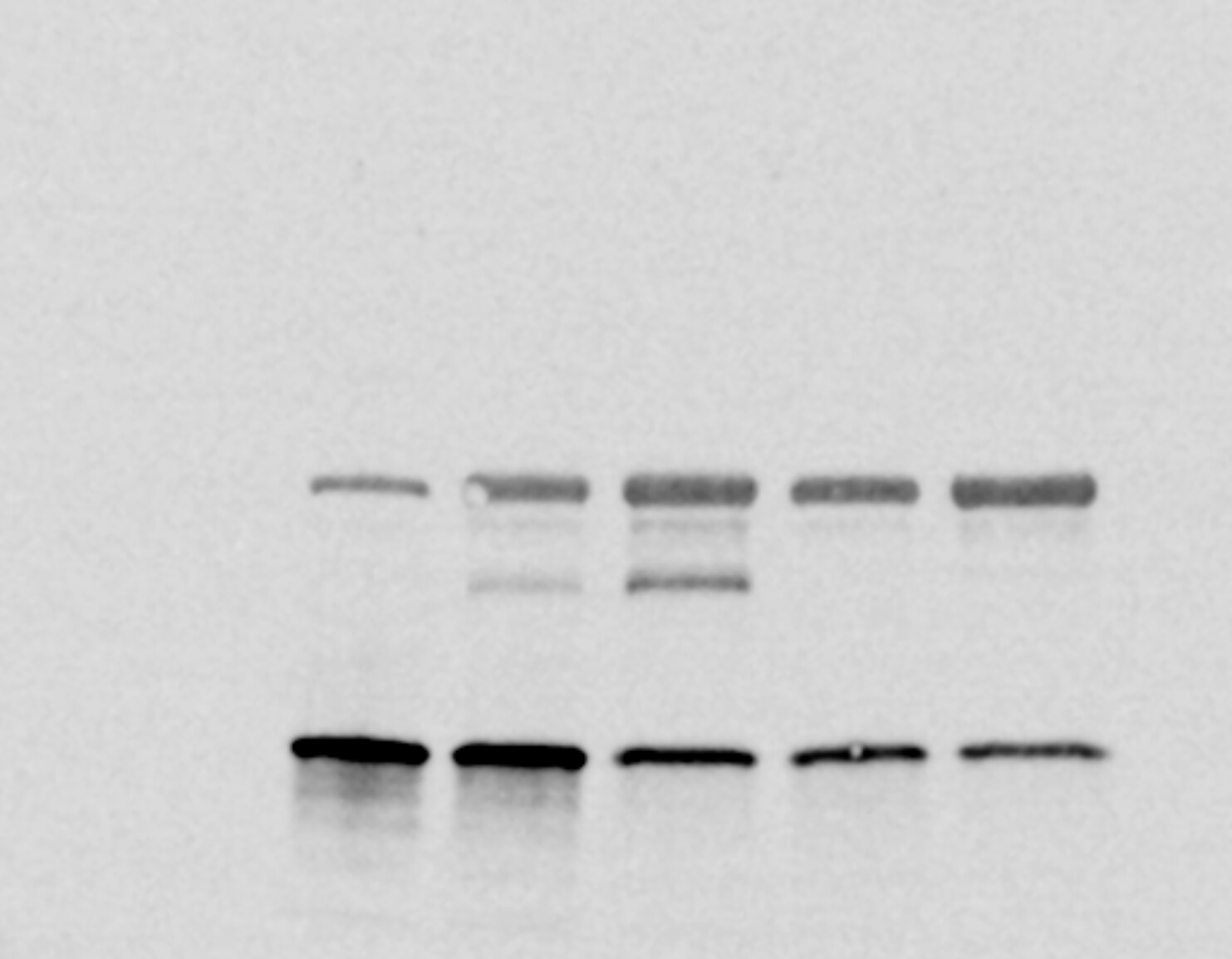 Human UCH-L1/PGP9.5 Antibody MAB6007