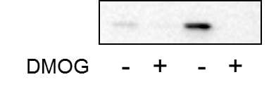 Human IL‑1 beta /IL‑1F2 Antibody MAB601