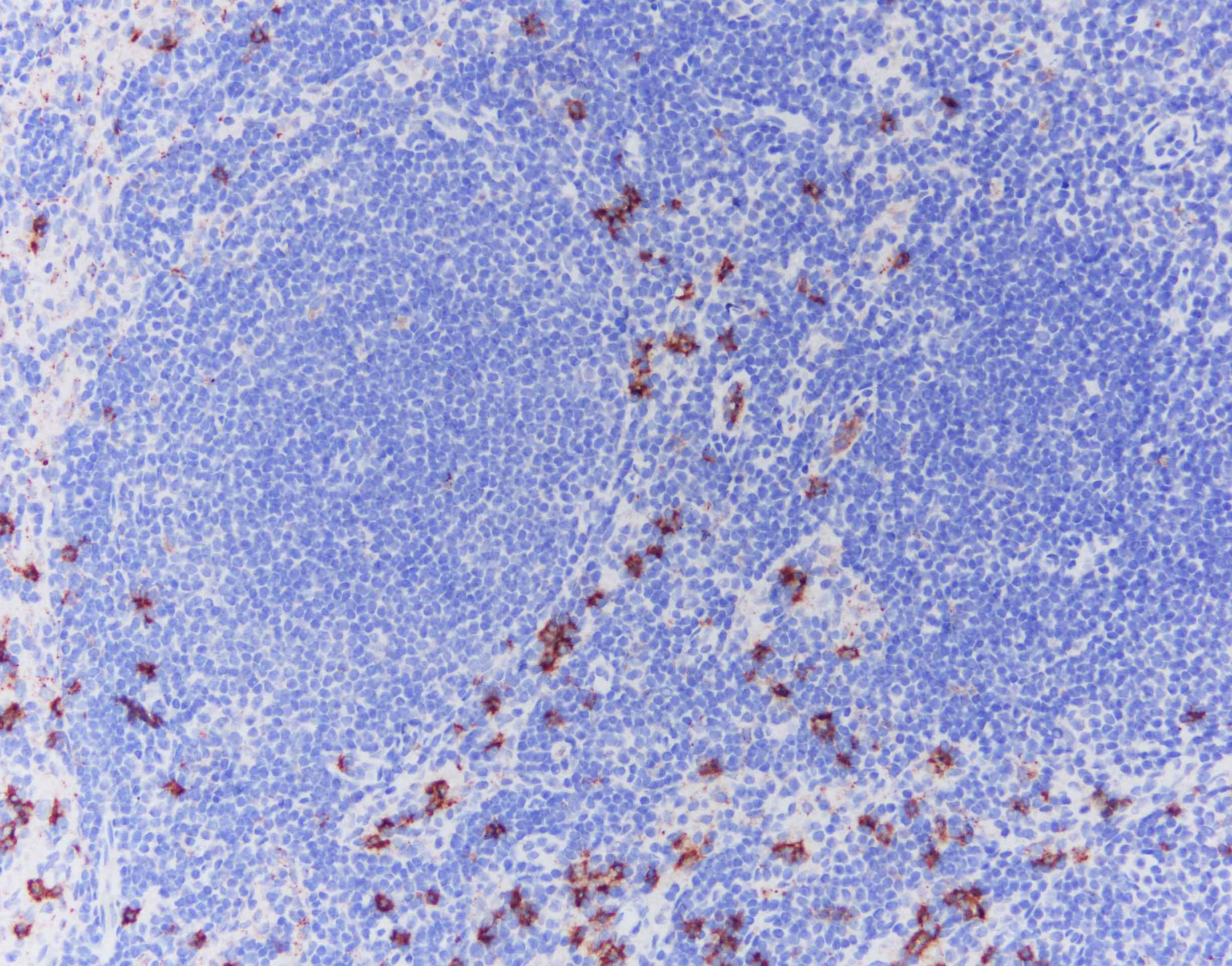 Human IL‑5 Antibody MAB605
