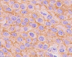 Human Neuroligin 3/NLGN3 Antibody MAB6088