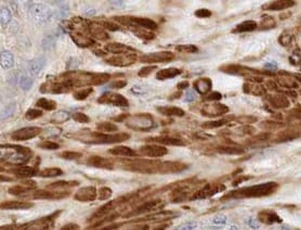 Human Adrenomedullin/ADM Antibody MAB6108
