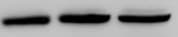 Human/Mouse ROR gamma /RORC/NR1F3 Antibody MAB6109