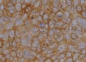 TGF‑ beta 2 Antibody MAB612