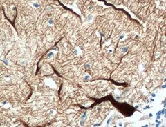 Human Brorin/VWC2 Antibody MAB6147