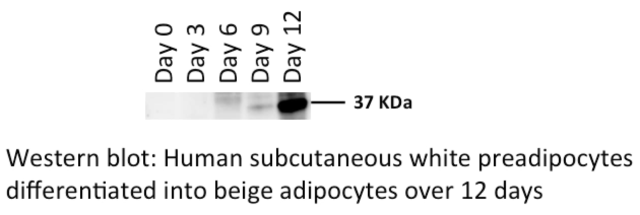 Human/Mouse UCP1 Antibody MAB6158