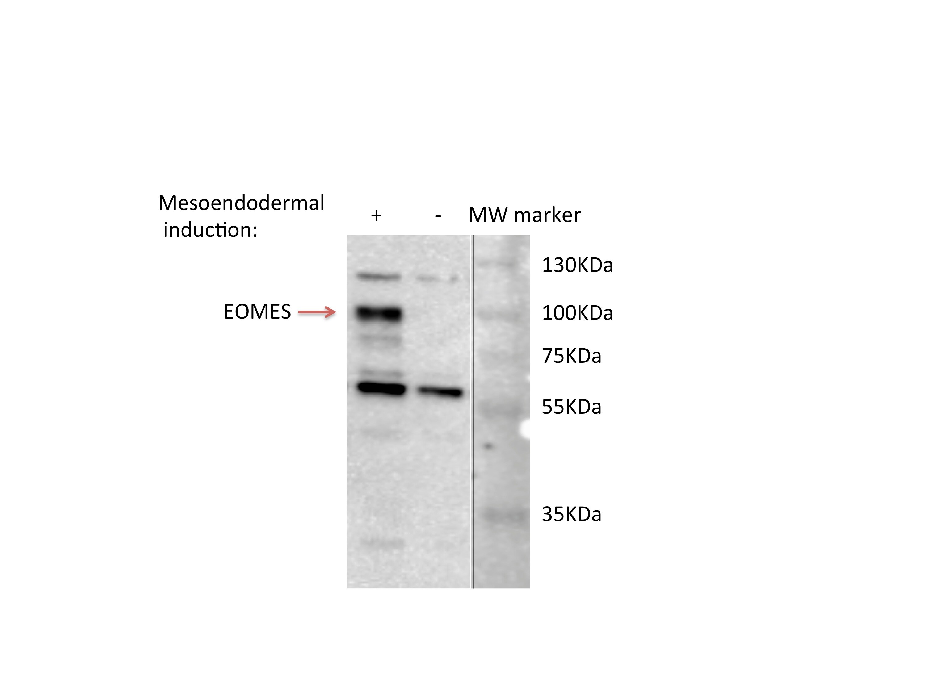 Human EOMES Antibody MAB6166