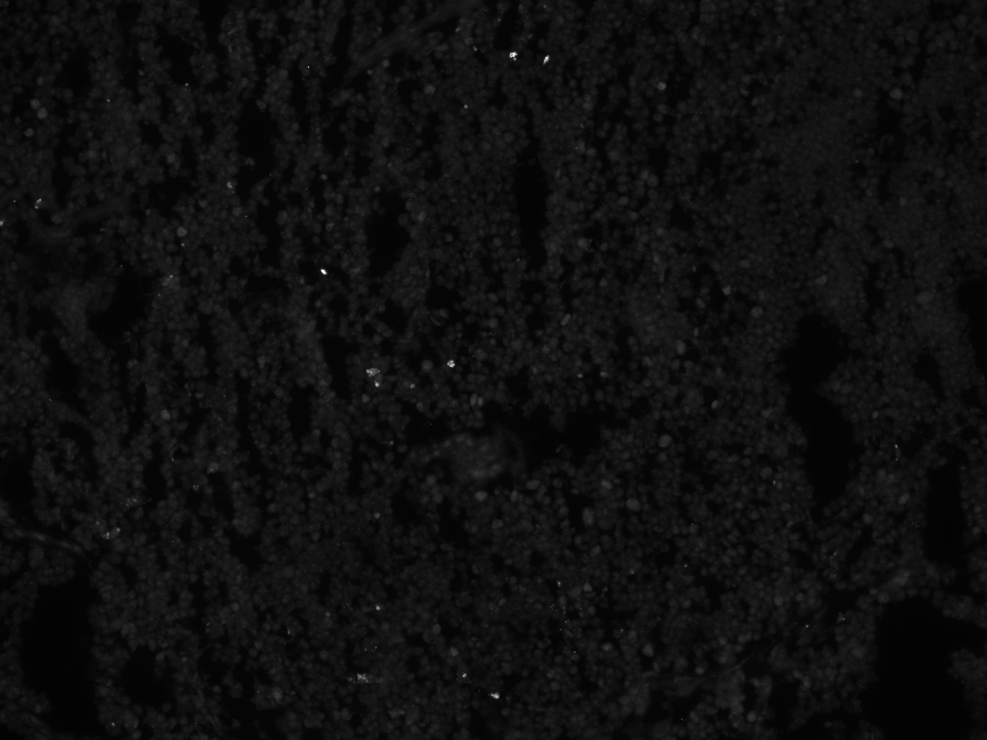 Human EOMES Antibody MAB6166