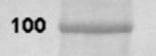 Human EOMES Antibody MAB6166