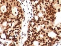 Human Histone Deacetylase 4/HDAC4 Antibody MAB6205