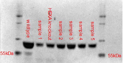 Human Hexosaminidase A/HEXA Antibody MAB6237