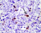 Human CD25/IL-2R alpha  Antibody MAB623