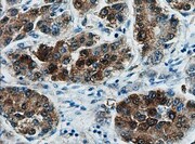 Human Pancreatic Polypeptide/PP Antibody MAB62971