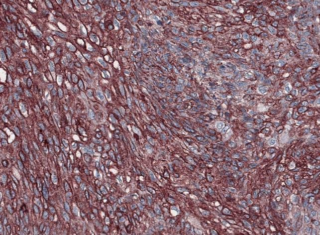 Human MUC‑1 Antibody MAB6298
