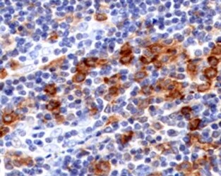 Human DLEC/CLEC4C/BDCA‑2 Antibody MAB62991