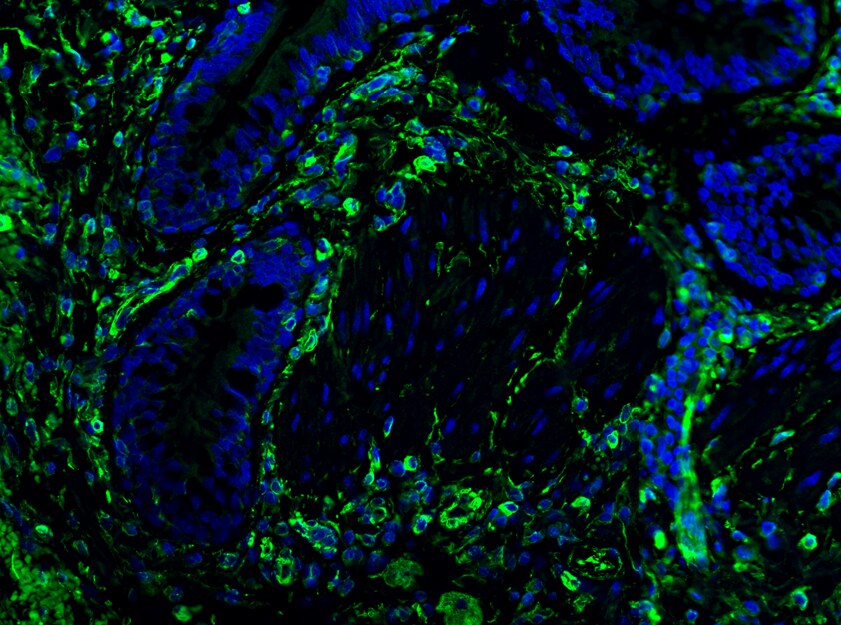 Human Collagen IV  alpha 1 Antibody MAB6308