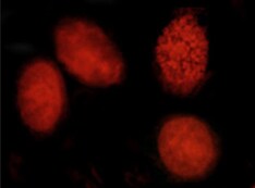 Human DNMT3A Antibody MAB6315