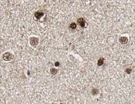 Human/Mouse VGF Antibody MAB6317