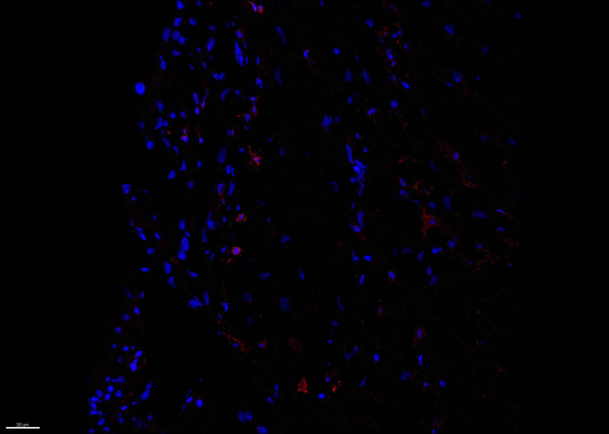Human LILRA2/CD85h/ILT1 Antibody MAB6364