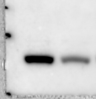 Human/Mouse DDX5 Antibody MAB6370