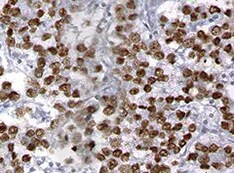 Human/Mouse SALL4 Antibody MAB6374
