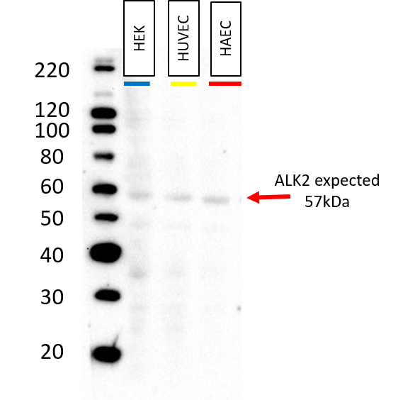 Human Activin RIA/ALK‑2 Antibody MAB637