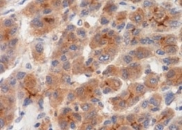 Mouse CEACAM‑1/CD66a Antibody MAB6480