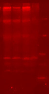 Human Glucuronosyltransferase 1A1/UGT1A1 Antibody MAB6490
