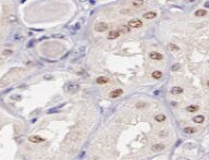 Human Amphiphysin/AMPH Antibody MAB6527