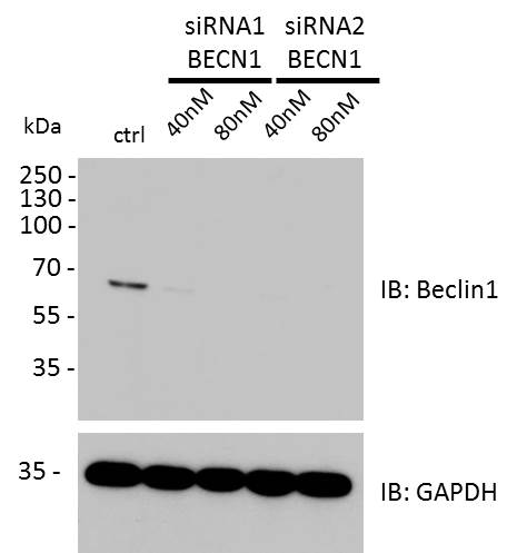 Human/Mouse ATG7 Antibody MAB6608