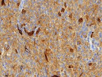 Human/Mouse ATG7 Antibody MAB6608