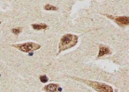 Human/Mouse ATG7 Antibody MAB6608